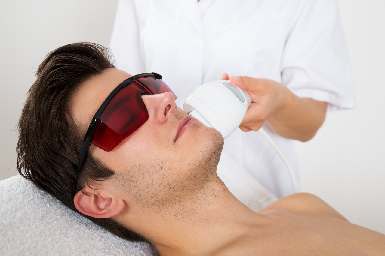 Saver for the Laser hair reduction treatment on face of a male